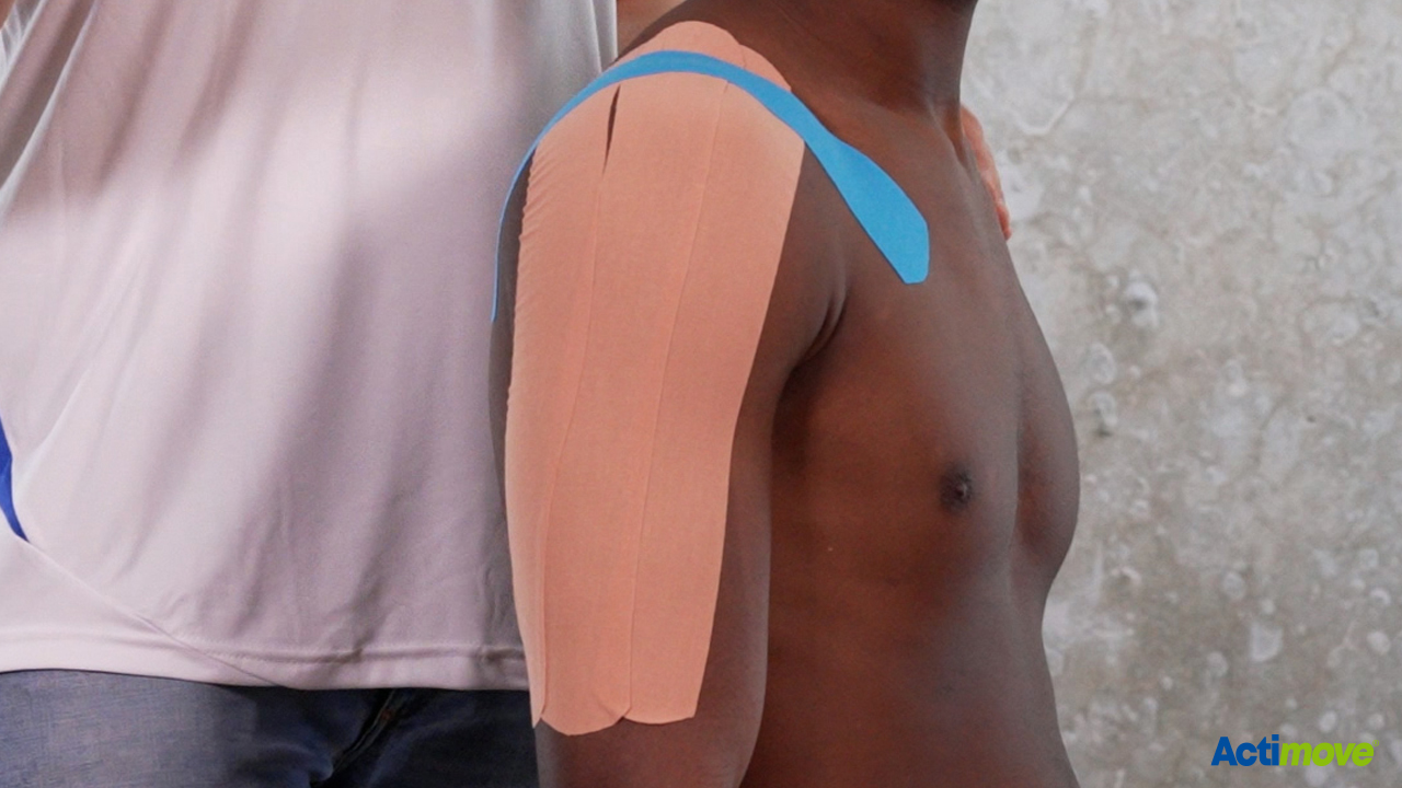 Taping kinesiologico per il dolore alla spalla Taping kinesiologico per il dolore alla spalla